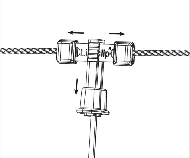 Litzclip Kit de réparation pour montants verticaux