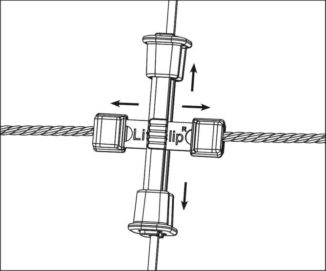 Litzclip Kit de réparation pour montants verticaux